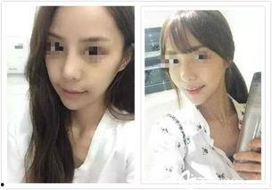 韩国鼻子图片,从明星鼻型看韩式审美趋势