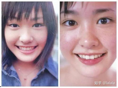 韩国鼻子图片,从明星鼻型看韩式审美趋势