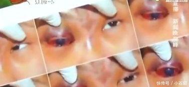 眼睛冒星星图片,揭秘眼睛冒星星的奇妙现象