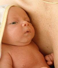 儿童过敏性皮炎图片,图片解析与防治要点